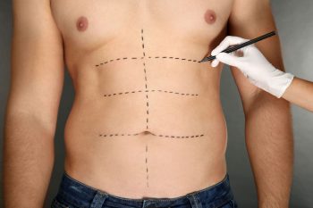 plastic-surgery-concept-female-hand-marking-male-belly-before-operating